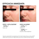 Side-by-side close-ups show a woman’s cheek before and after using Crema Idratante Intensiva. Text highlights smoother, more hydrated skin with visible improvements over 30 days, emphasizing the effects of idratazione profonda and nutrimento intenso. Eyes are covered by a black bar for anonymity.