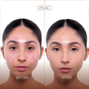 Side-by-side photos of a woman’s face. Left: visible acne and redness labeled Before. Right: clear, smooth skin with an effetto naturale labeled After, achieved with NUDISSIMO GLOW – Fondotinta naturalmente luminoso. Both photos have similar lighting and hairstyle. 254C is written at the top.