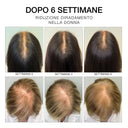 Sei foto, in italiano, mostrano viste dall'alto di teste di donne prima e dopo 6 settimane di utilizzo di SIERO 6 - Trattamento rinforzante per crescita capelli e cuoio capelluto. Le immagini rivelano una riduzione del diradamento dei capelli e una crescita visibile dei capelli scuri e biondi.
