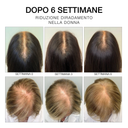 ESTREMIRIMEDI -  Serum 6 - Scalp & Hair Fortifying Treatment